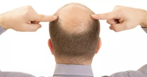 hair loss becomes more common